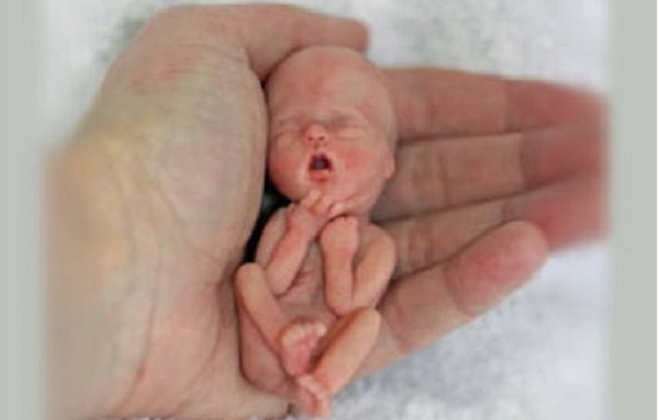 Bébé avorté