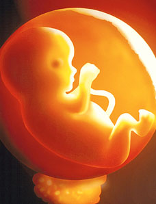 Foetus